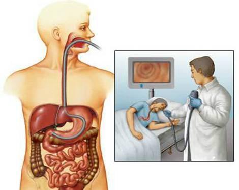 照胃镜前的准备