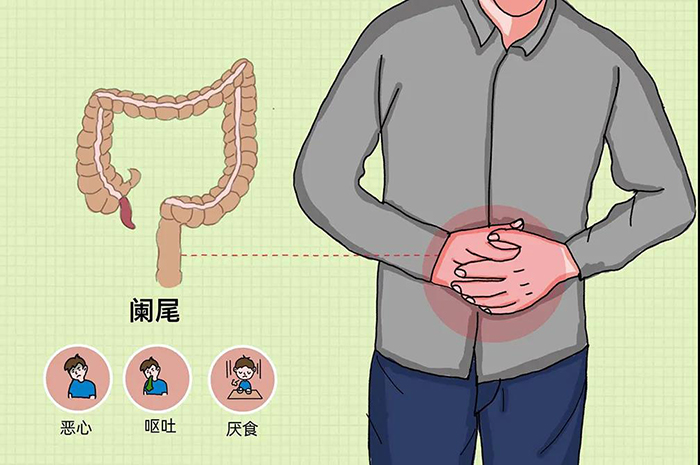 阑尾炎保守治疗易复发,究竟要不要做手术?