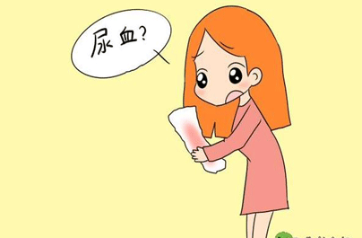 维生素c以及维生素k缺乏症,白血病,血友病等,这些都会导致尿血的发生