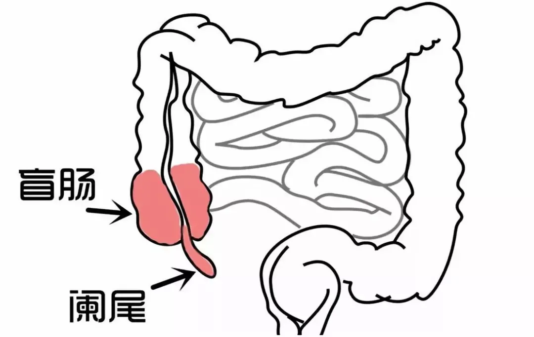 阑尾炎的这些症状，你真的了解吗？