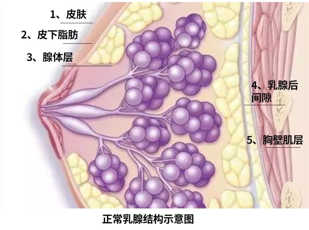 体检发现乳腺结节，会变成乳腺癌吗？