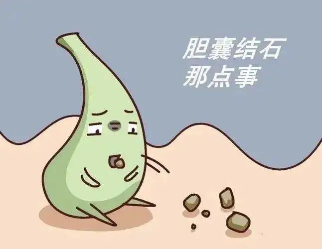 得了胆囊结石，没感觉，可以不治疗吗？