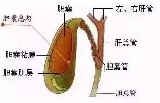 体检发现了胆囊息肉，该切还是不该切？