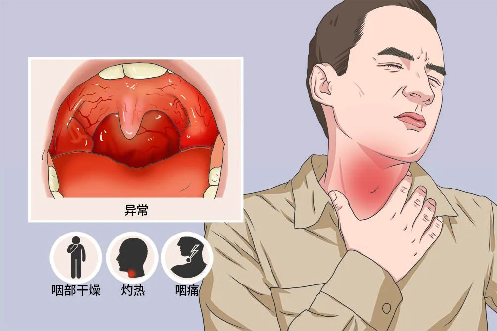 咽喉炎频繁发作，警惕这4个习惯