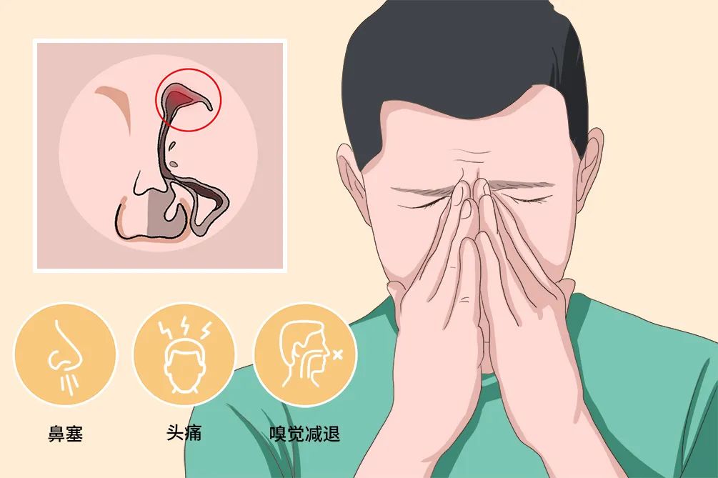 鼻窦炎本身不可怕，怕的是病变？