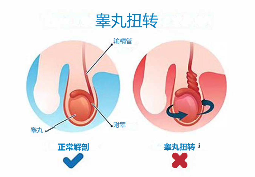 闲得蛋疼，可能是“蛋”真的疼了